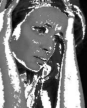 Faire reconnaître la fibromyalgie comme maladie véritable