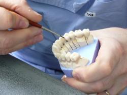 Dentistes et prothésistes dentaires mutualistes : les prothèses de la honte !