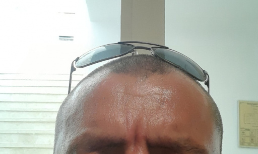 Revalorisation de l handicap