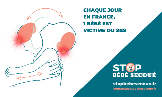 Chaque jour en France, 1 bébé est victime du syndrome du bébé secoué : il est temps d’agir !