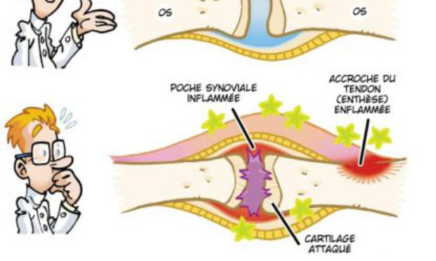 Je souhaite que le Lumirelax, d&eacute;contractant musculaire tr&egrave;s efficace pour les spondylarthrites ankylosantes et autres maladie inflammatoires et musculaires soit rembours&eacute; par la s&eacute;curit&eacute; sociale comme auparavant car c'est un m&eacute;dicament tr&egrave;s utile.