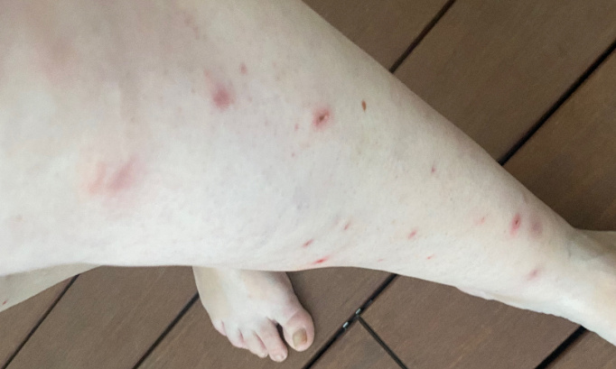 Pour l'éradication des moustiques tigre sur la commune de Belleville-en-Beaujolais