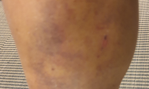 Mise en danger des citoyens : la loi sur les chiens de cat&eacute;gorie 1 et 2 n'est pas respect&eacute;e en France