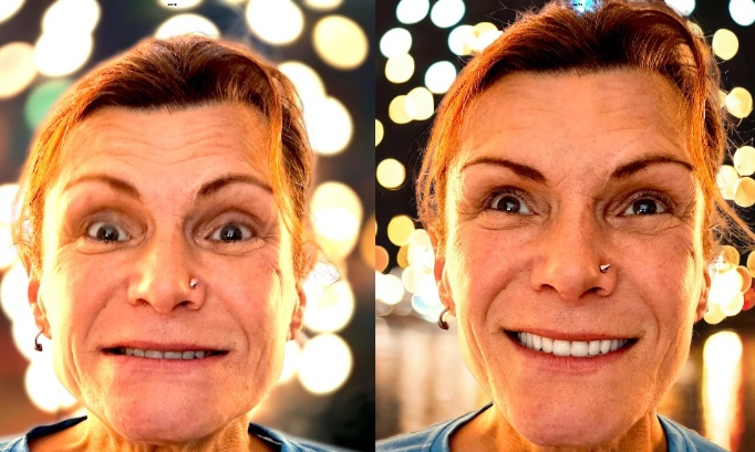 Pour des prothèses dentaires accessibles et des délais plus courts pour tous !! Dental prosthetics for all citizens and faster !!