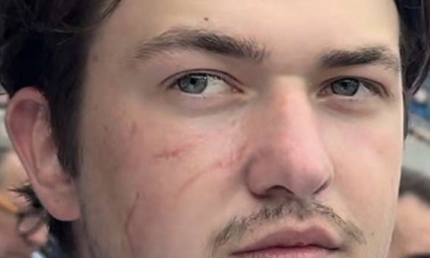 Tué sans permis = homicide volontaire - Justice pour mon petit frère tué par un chauffard !