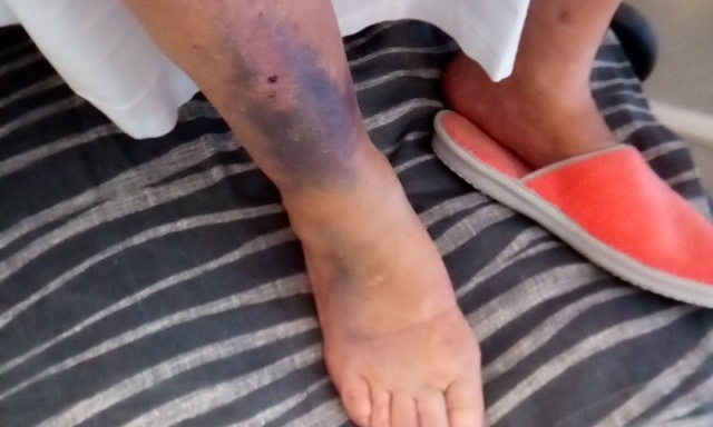 Stop aux décès obscures et à la maltraitance sur des personnes âgées en Unité Soins Longue Durée