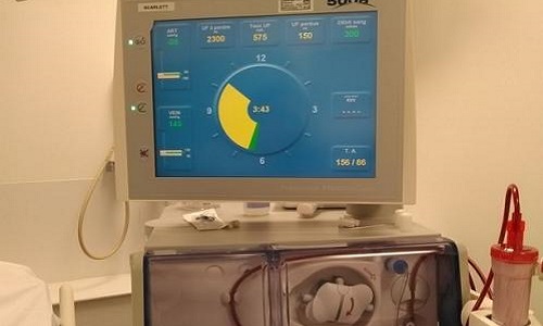 Gratuité de la télévision pour les dialysés du Centre Hospitalier Sud Francilien