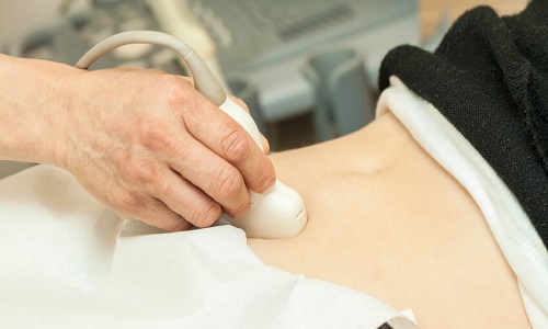 Oui au remboursement de l'IVG