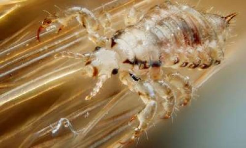 Interdisons le massacre des poux !  - Stop the lice slaughter !