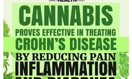 Légaliser et rembourser le cannabis médicinal pour la maladie de Crohn et RCH