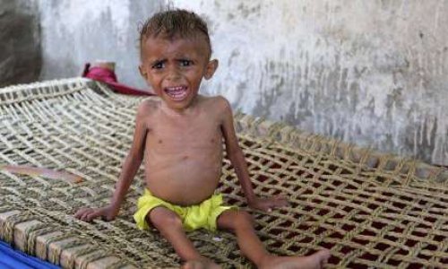 Les enfants du Yémen abandonnés par les puissants de la planète : crime contre l'Humanité