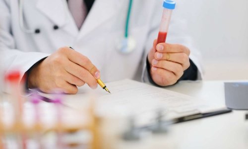 Nous voulons des moyens suffisants pour que tous nos lycéens puissent réaliser des expériences dans des conditions normales !