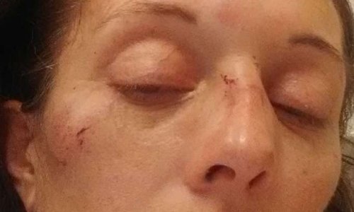 Prendre en compte notre courrier envoyé en recommandé pour le signalement d'une femme battue !