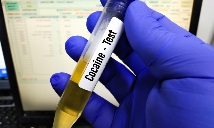 Exigeons un dépistage de drogue pour le Président de la république Emmanuel Macron et pour les membres de son gouvernement.