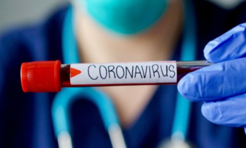 Pour des tests généralisés concernant le coronavirus !