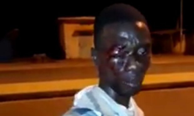 Non à la violence policière lors du couvre-feu au Togo