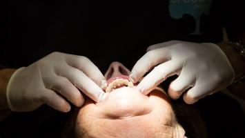 Que pensez-vous des cabinets dentaires low-cost ?