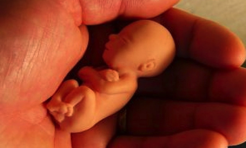 Refusez-vous, avec François Fillon, d'abroger la loi autorisant la recherche sur l'embryon humain?
