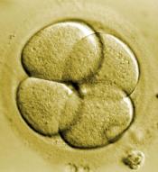 Êtes vous pour ou contre l'utilisation des Cellules Souches Embryonnaires humaines à des fins thérapeutiques ?